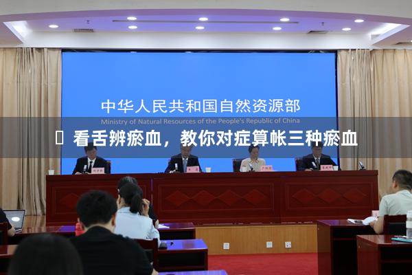 ​看舌辨瘀血，教你对症算帐三种瘀血